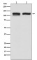 USP11 Rabbit mAb ABZ4940
