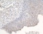 CCR3 Rabbit mAb ABZ4941