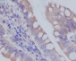 Rab7 Rabbit mAb ABZ4943