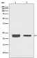 Rab7 Rabbit mAb ABZ4943