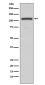 PI3 Kinase p110 beta Rabbit mAb ABZ4950