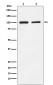Glutamate receptor 2 Rabbit mAb ABZ4952