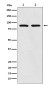 Thrombopoietin Receptor Rabbit mAb ABZ4954