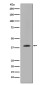 MMP12 Rabbit mAb ABZ4955