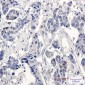 p21 Rabbit mAb ABZ4956