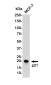 p21 Rabbit mAb ABZ4956