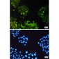 ATP6V1E1 Rabbit mAb ABZ4958
