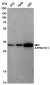 ATP6V1E1 Rabbit mAb ABZ4958
