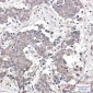 GRK3 Rabbit mAb ABZ4961