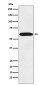 STIP1/STI1 Rabbit mAb ABZ4962