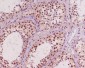 AKT1/2/3 Rabbit mAb ABZ4964