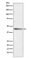 RRM2 Rabbit mAb ABZ4965