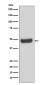 PRKAR2B Rabbit mAb ABZ4966