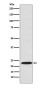 PSMB8 Rabbit mAb ABZ4971