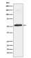 PTBP1 Rabbit mAb ABZ4972