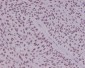 YY1 Rabbit mAb ABZ4975