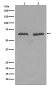 YY1 Rabbit mAb ABZ4975