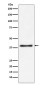 Aspartate Aminotransferase Rabbit mAb ABZ4978