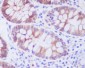 Stathmin 1 Rabbit mAb ABZ4979