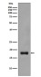 Stathmin 1 Rabbit mAb ABZ4979