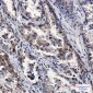 Stathmin 1 Rabbit mAb ABZ4980
