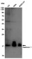 Stathmin 1 Rabbit mAb ABZ4980