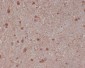 S100 beta Rabbit mAb ABZ4982