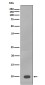 S100 beta Rabbit mAb ABZ4982