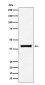 Aldolase Rabbit mAb ABZ4983