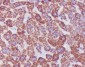 Catalase Rabbit mAb ABZ4984