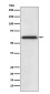 Catalase Rabbit mAb ABZ4984