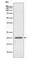 Ferritin Rabbit mAb ABZ4987