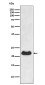 Alpha B Crystallin Rabbit mAb ABZ4988
