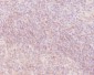 Human IgM Rabbit mAb ABZ4989