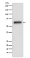 Human IgG3 Rabbit mAb ABZ4990
