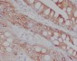 CD8 alpha Rabbit mAb ABZ4991