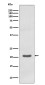 MTCO2 Rabbit mAb ABZ4994