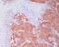 ALDH1A1 Rabbit mAb ABZ4995