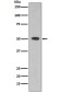 ALDH1A1 Rabbit mAb ABZ4995