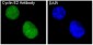 Cyclin E2 Rabbit mAb ABZ4996