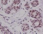 Cyclin E2 Rabbit mAb ABZ4996