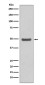 Cyclin E2 Rabbit mAb ABZ4996