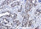 Glutaminase Rabbit mAb ABZ5000