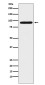 ALDH1L1 Rabbit mAb ABZ5002