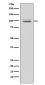 MKLP1 Rabbit mAb ABZ5003