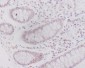 Caveolin-2 Rabbit mAb ABZ5005
