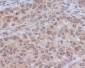 ERK2 Rabbit mAb ABZ5006