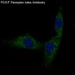 PDGFR beta Rabbit mAb ABZ5007