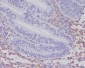 PDGFR beta Rabbit mAb ABZ5007