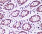 CSNK2A1 alpha Rabbit mAb ABZ5010